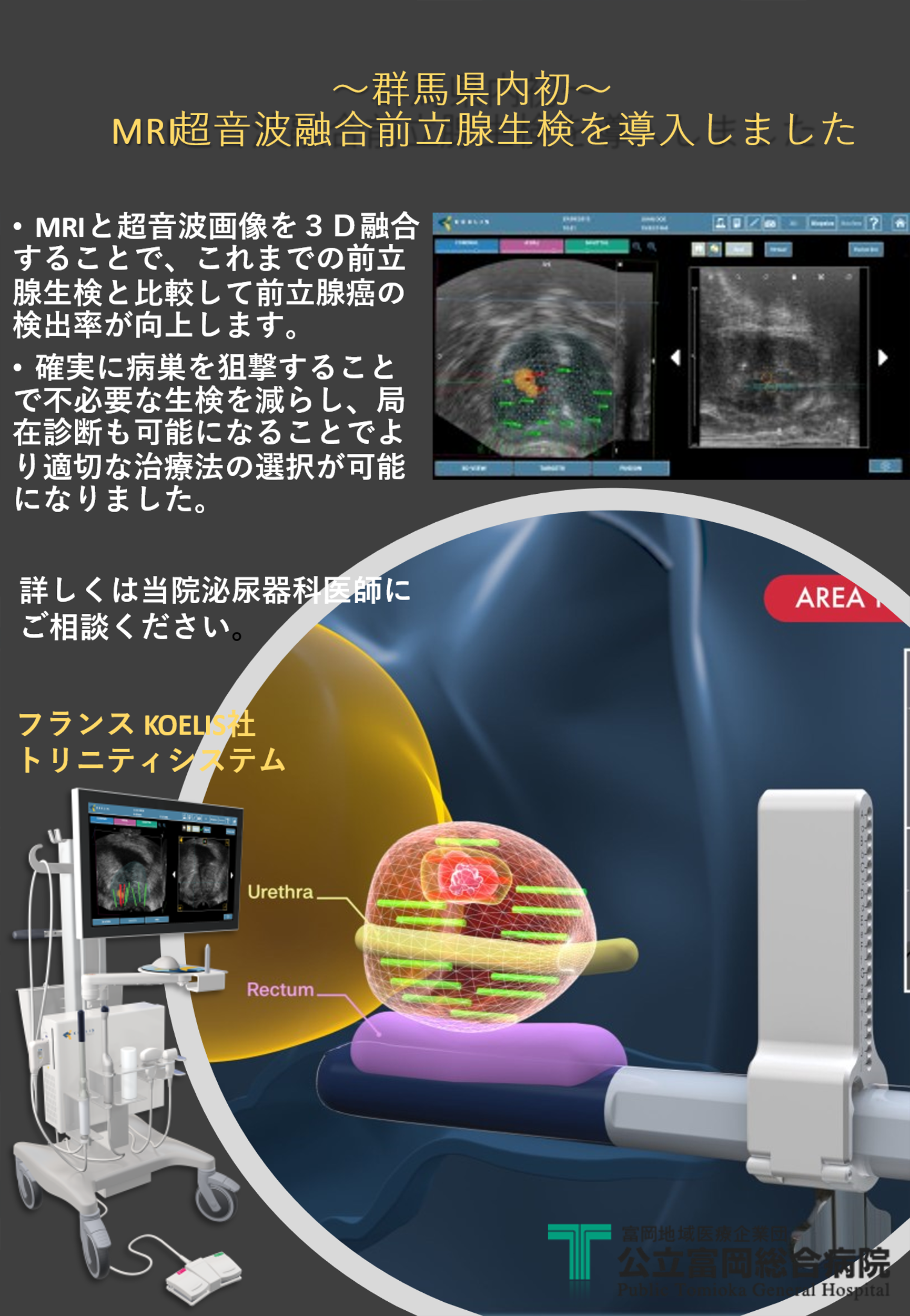 ＭＲＩ超音波融合前立腺生検